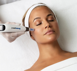Microneedling med Dermapen 4 hos AS Skinclinic i Norrköping